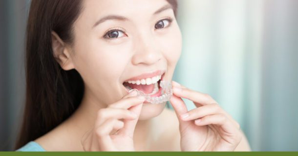 woman about to place Invisalign clear aligner on her teeth